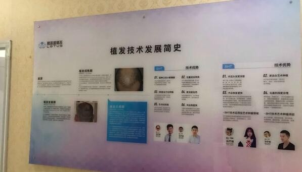 武汉碧莲盛植发